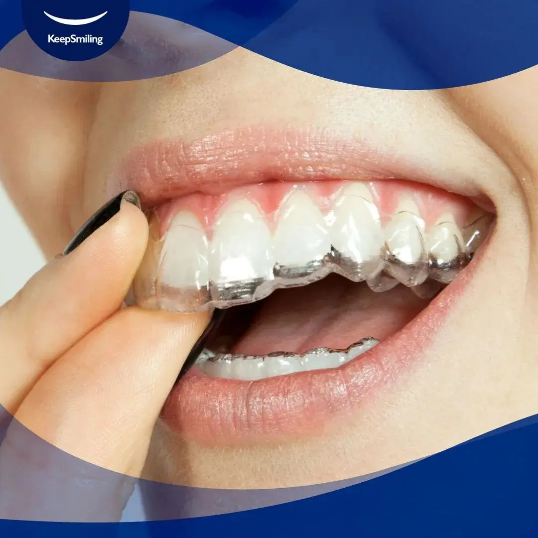 Alineadores invisibles